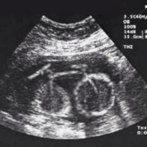 Click image for larger version

Name:	553141606_1102849568717649_312426118348227691_n.jpg
Views:	1
Size:	34.1 KB
ID:	67089